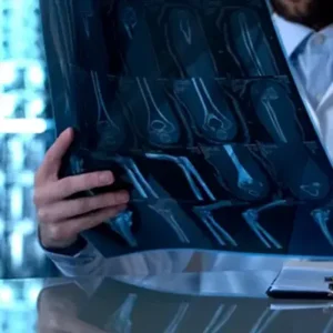 قسم جراحة العظام